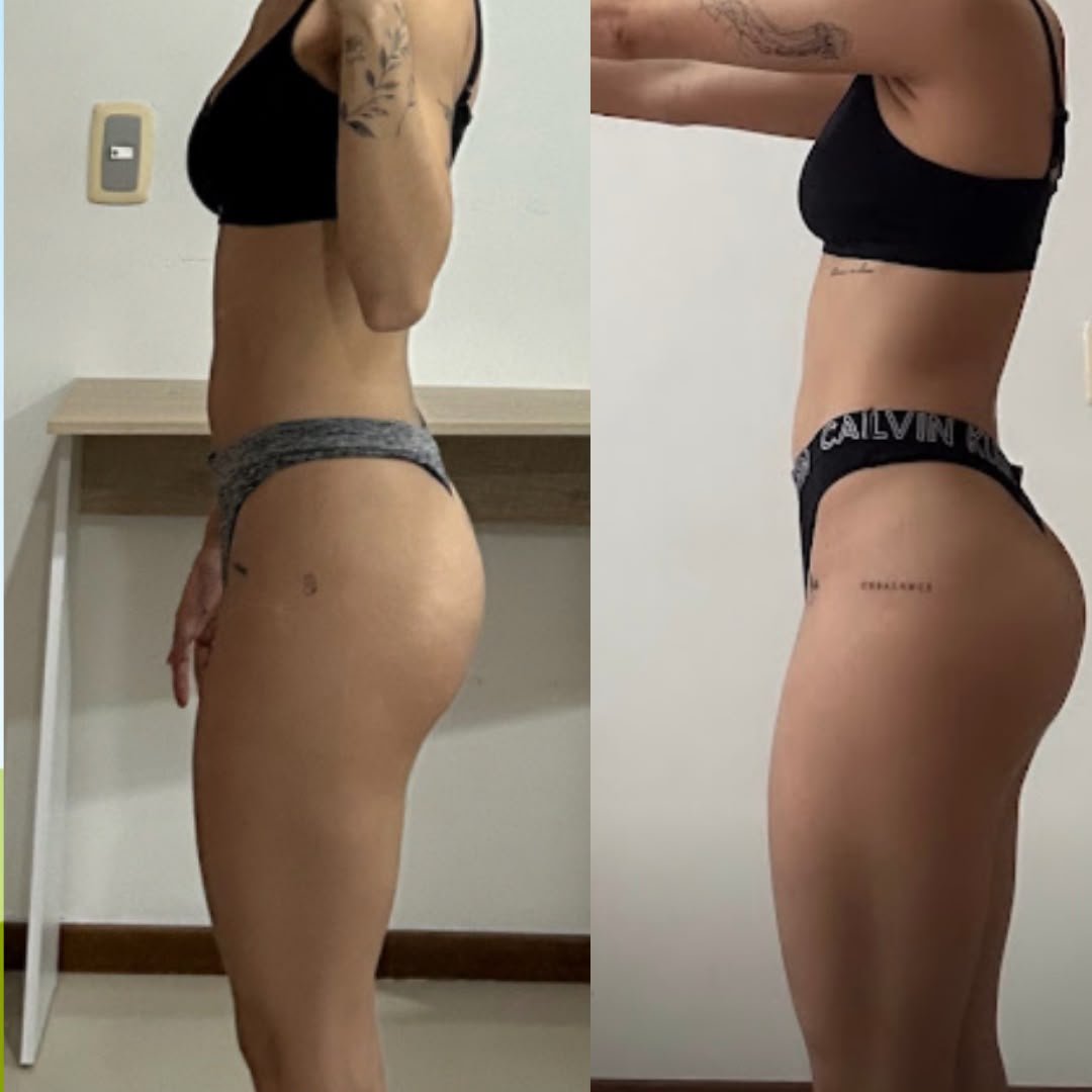 Transformación de glúteo de una alumna, antes y después