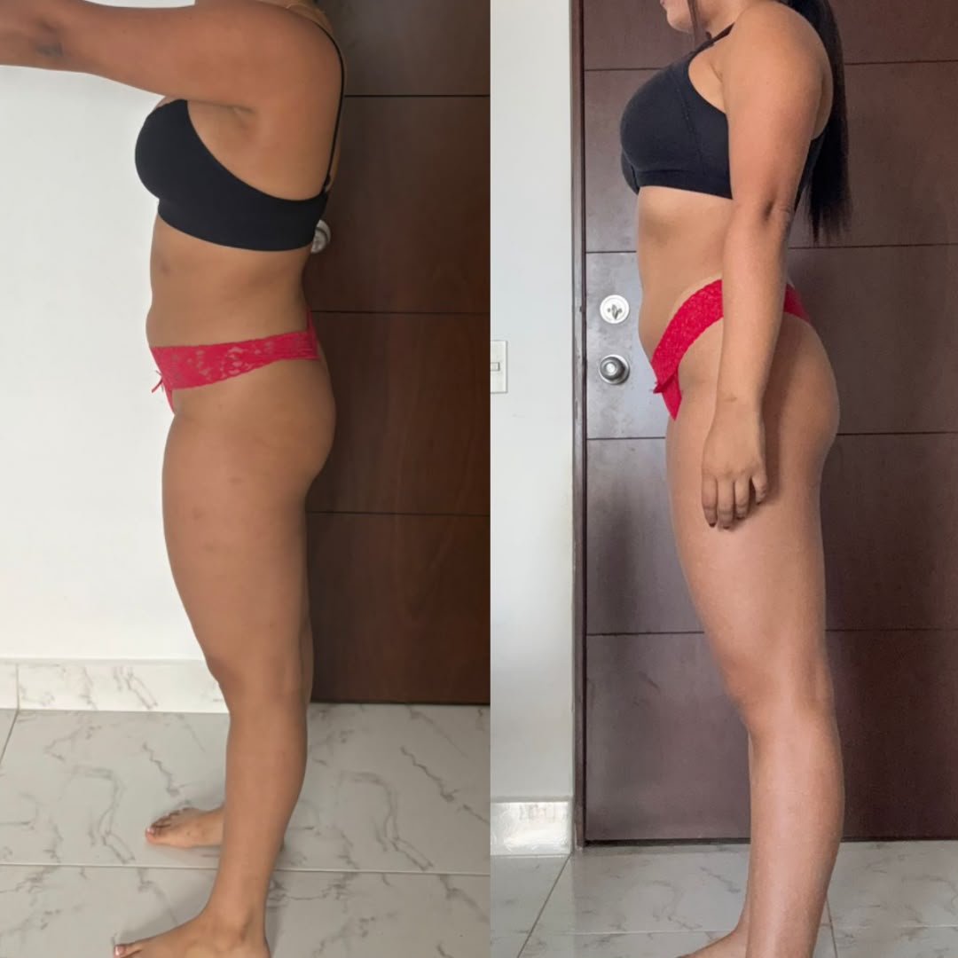Transformación de glúteo de una alumna, antes y después
