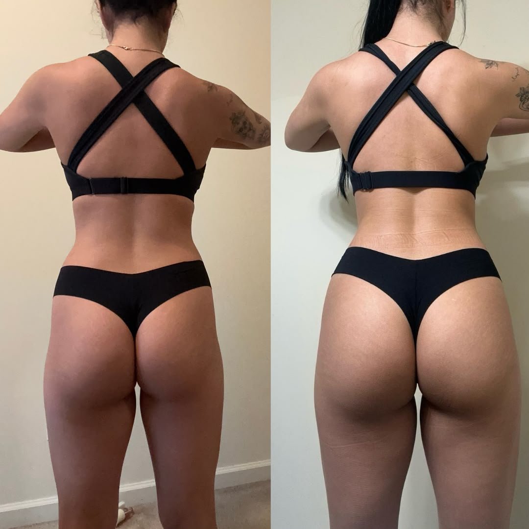 Transformación de glúteo de una alumna, antes y después