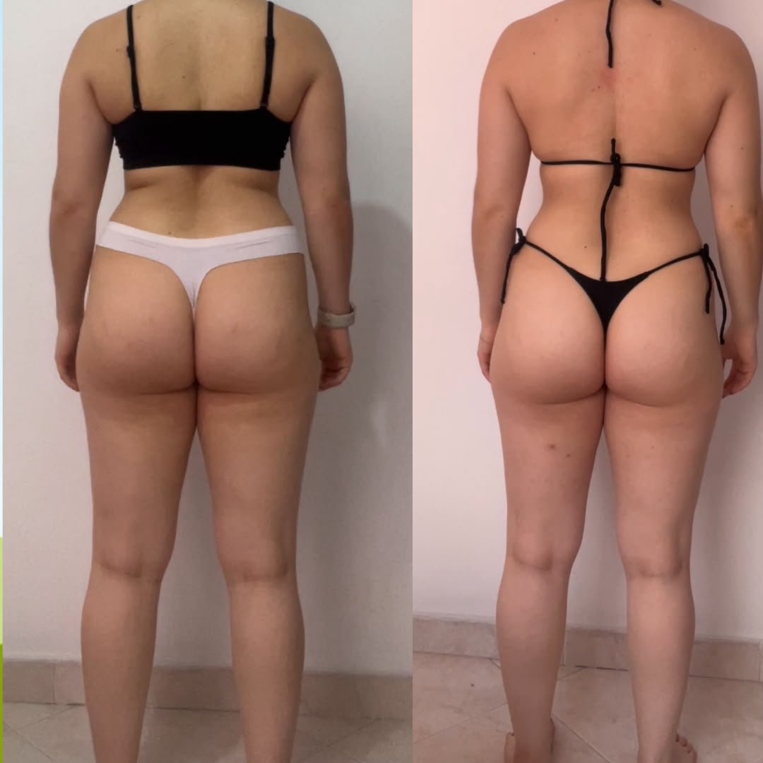 Transformación de glúteo de una alumna, antes y después